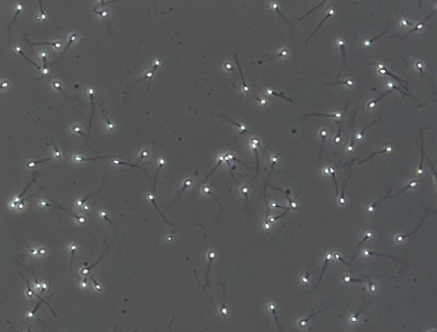 CellVision - Glass Disposable Counting chambers