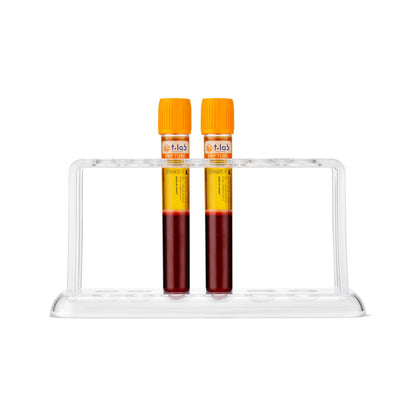 Platelet Rich Plasma, prp tubes from T-L:ab