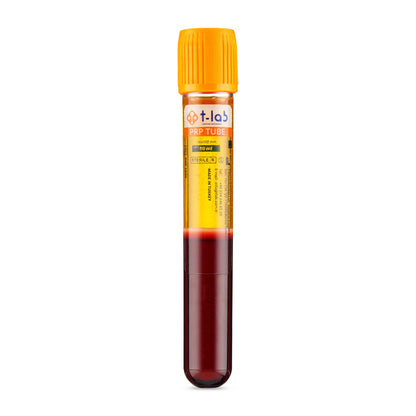 Platelet Rich Plasma, PRP tube from T-Labs, blood filled